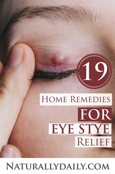 stye inside eyelid remedy