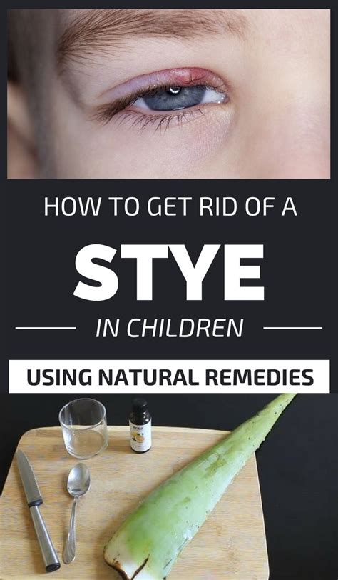 stye treatment for toddler
