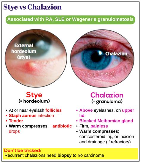 stye vs chalazion vs blepharitis