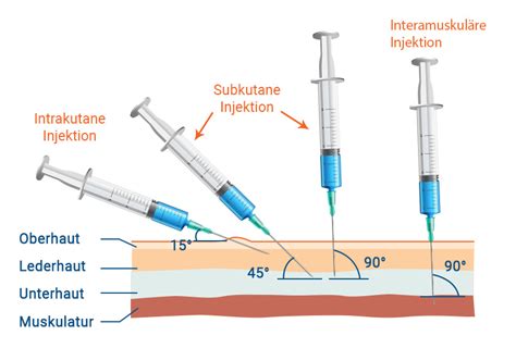 subkutane injektion