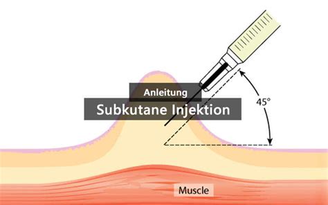 subkutane injektion komplikationen