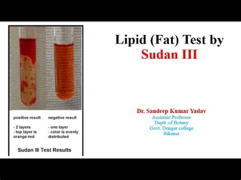 sudan iii test for lipids