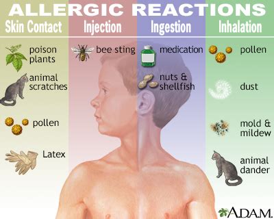 Sudden Allergy Attack Causes