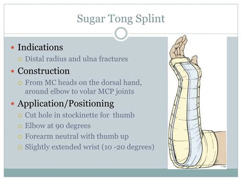 Sugar Tong Splint Procedure Code