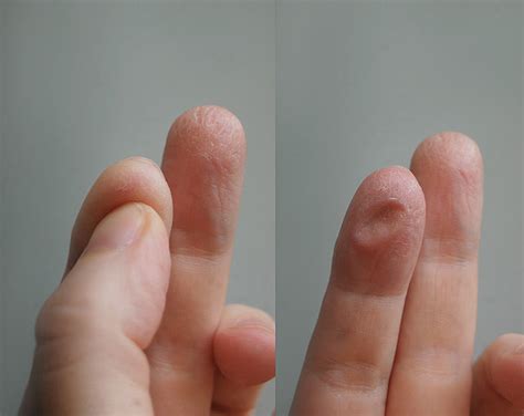 Super Dry Fingertips