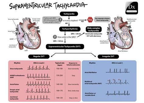 supraventricular and ventricular arrhythmias