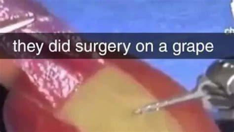 They Did Surgery On a Grape Know Your Meme