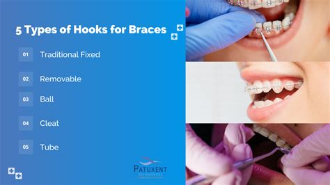 Surgical Hooks For Braces