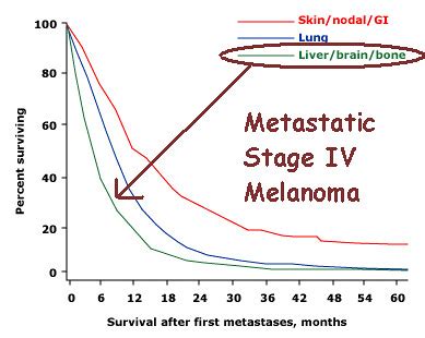 survival rate of stage 4 metastatic melanoma