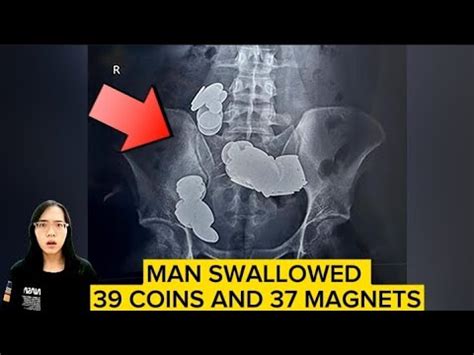 swallowed 39