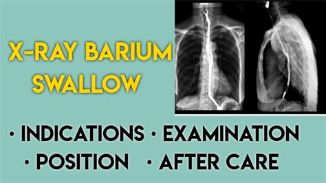 swallowing function with video radiograph cpt code