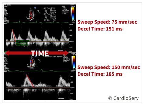 Sweep Speed Oscilloscope