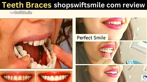 swift smile teeth reviews