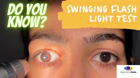 Swinging Flashlight Eye Test