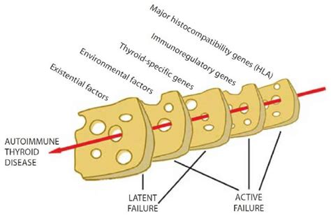 Swiss Cheese Thyroid