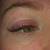 swollen eyelids after lash extensions