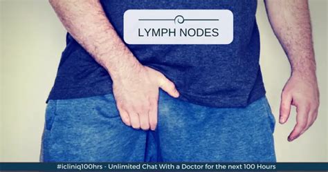 swollen inguinal lymph nodes