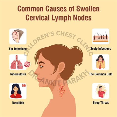 What Causes a Swollen Lymph Node in the Neck and How to Treat It