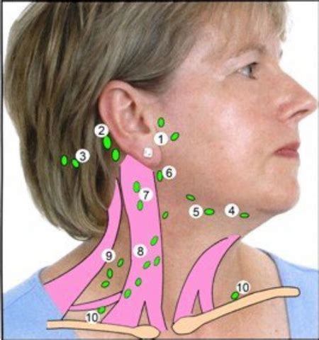What Causes a Swollen Lymph Node Under Ear?
