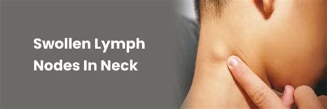 What Causes Swollen Lymph Nodes at Neck?