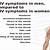 symptom of hiv in males