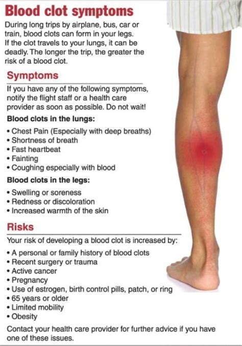 The Dangers of Deep Vein Thrombosis Almawi Limited The