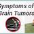 symptoms brain stem tumor dogs