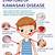 symptoms of covid kawasaki disease in child