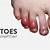 symptoms of covid toes