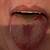symptoms of covid tongue