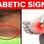 symptoms of diabetes youtube