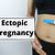 symptoms of ectopic pregnancy at 8 weeks