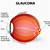 symptoms of glaucoma nhs