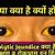 symptoms of jaundice in hindi