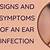 symptoms of omron ear
