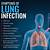 symptoms when lungs are targeted by microbes