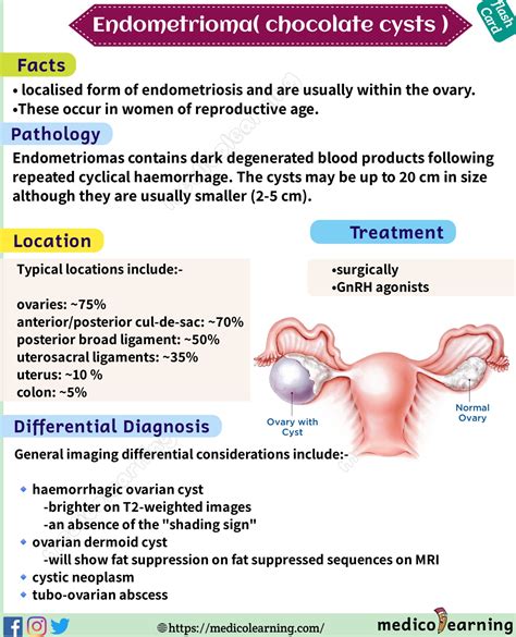 symptoms of endometrioma cyst