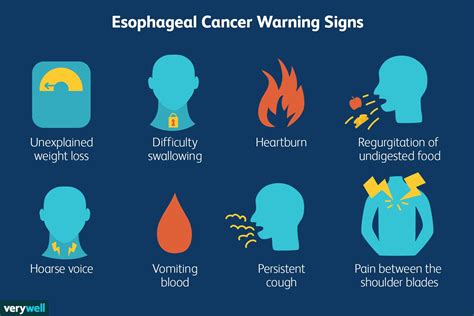 symptoms of esophageal cancer nhs