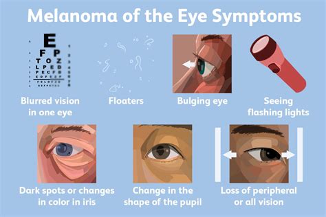 symptoms of eye melanoma