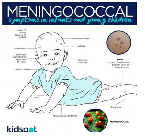 symptoms of meningitis bacterial