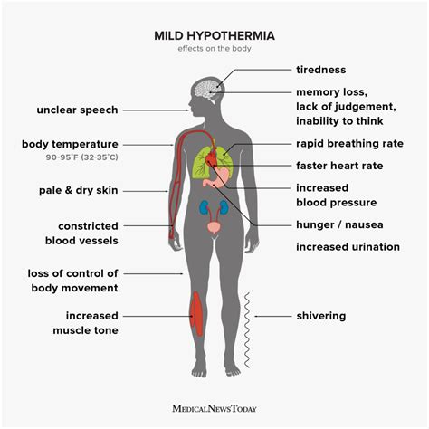 symptoms of mild hypothermia