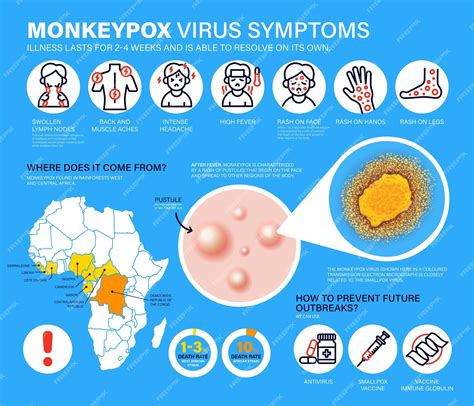 symptoms of monkeypox virus