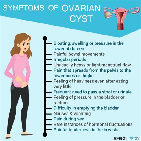 symptoms of ovarian cyst