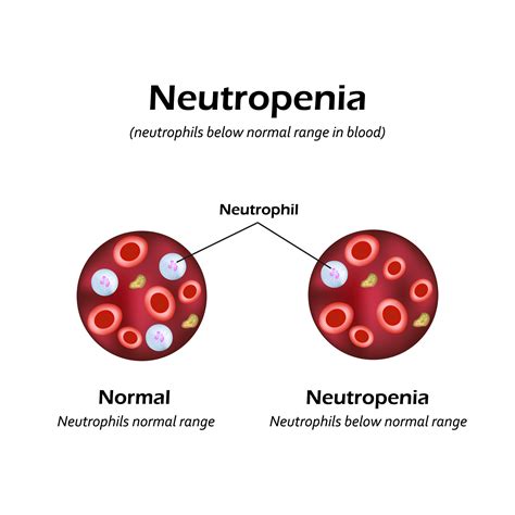 symptoms of severe neutropenia