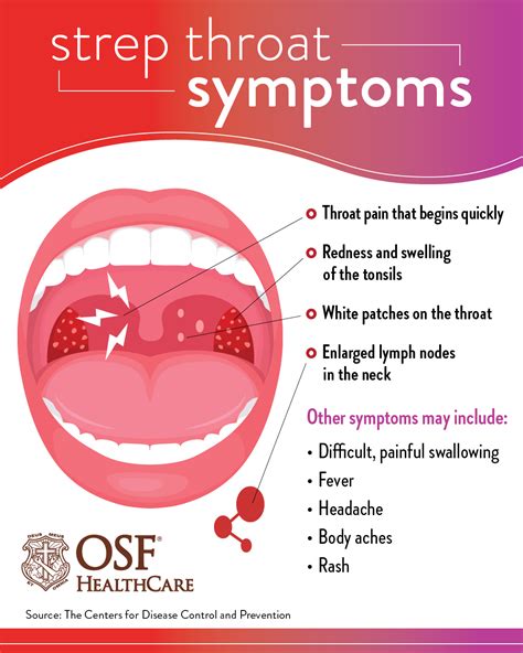 symptoms of streptococcal tonsillitis