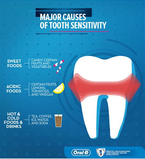 symptoms of tooth sensitivity