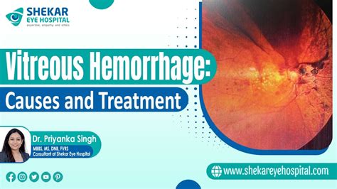 symptoms of vitreous hemorrhage