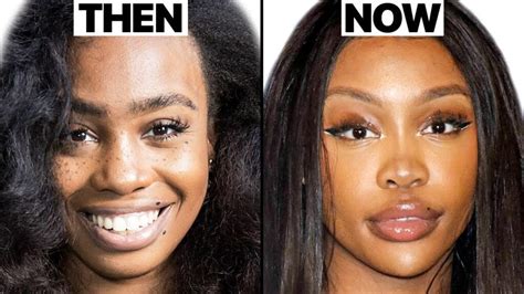 SZA Pre-Plastic Surgery Transformation: Stunning Evolution Explored