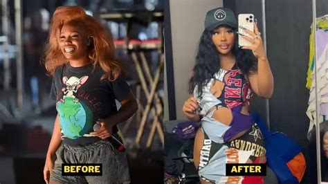 SZA Plastic Surgery Rumors: Separating Fact from Speculation