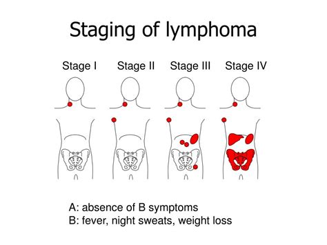 t cell lymphoma staging